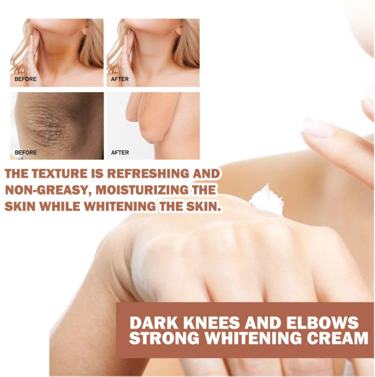 EELHOE Joint Darkening & Brightening Cream Moisturizing & Brightening Dark Skin Joint & Elbow Repair Cream